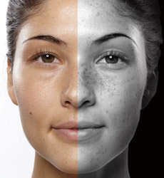 reverse sun damage