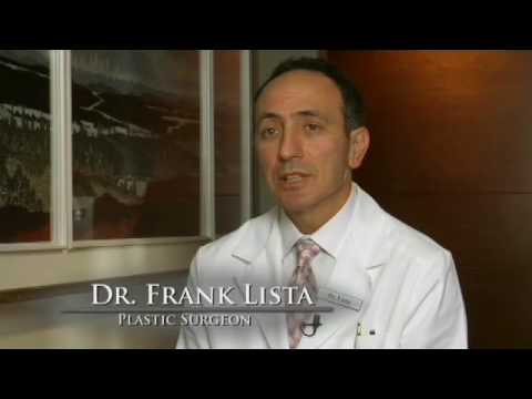 Dr. Lista Describes Facelift Surgery